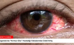 Uganda’da “Kırmızı Göz” Hastalığı Vakalarında Ciddi Artış